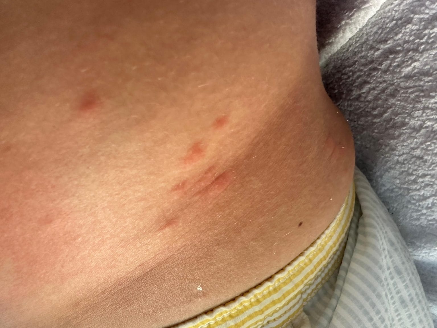 traitement punaises paris 11